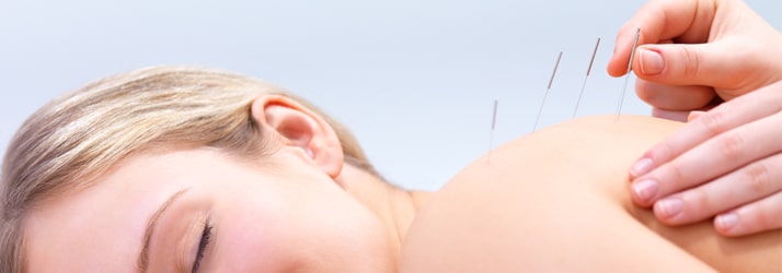 Acupuncture in Crosby MN Acupuncture in Crosby MN